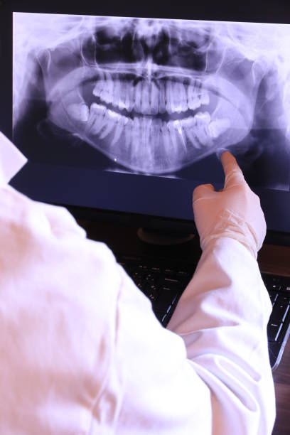Best Emergency Tooth Extraction in Layton, UT